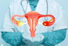 بیماری های رحم و تخمدان